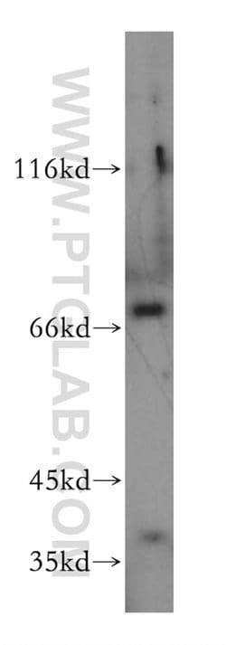 LSS Rabbit anti-Human, Mouse, Rat, Polyclonal, Proteintech 150 &mu;L; Unconjugated:Antibodies,