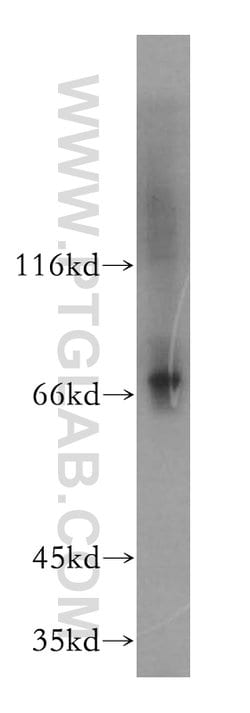 LSS Rabbit anti-Human, Mouse, Rat, Polyclonal, Proteintech 150 &mu;L; Unconjugated:Antibodies,