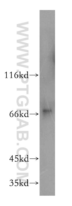 LSS Rabbit anti-Human, Mouse, Rat, Polyclonal, Proteintech 150 &mu;L; Unconjugated:Antibodies,
