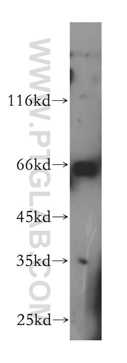 LSS Rabbit anti-Human, Mouse, Rat, Polyclonal, Proteintech 150 &mu;L; Unconjugated:Antibodies,