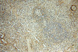 TSPAN7 Rabbit anti-Human, Mouse, Polyclonal, Proteintech:Antibodies:Primary