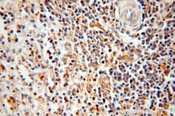 TSPAN7 Rabbit anti-Human, Mouse, Polyclonal, Proteintech:Antibodies:Primary