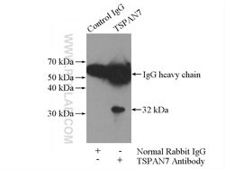 TSPAN7 Rabbit anti-Human, Mouse, Polyclonal, Proteintech:Antibodies:Primary