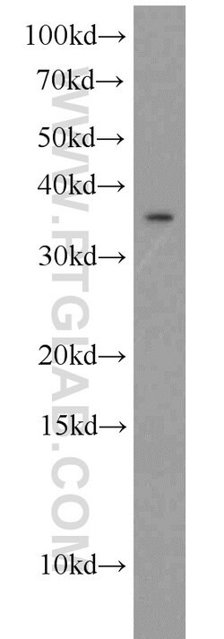 TSPAN7 Rabbit anti-Human, Mouse, Polyclonal, Proteintech:Antibodies:Primary