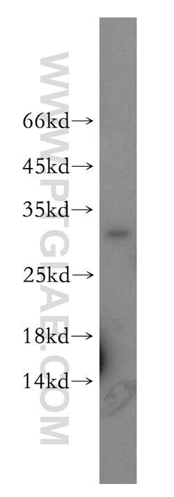 TSPAN7 Rabbit anti-Human, Mouse, Polyclonal, Proteintech:Antibodies:Primary