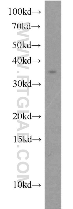 TSPAN7 Rabbit anti-Human, Mouse, Polyclonal, Proteintech:Antibodies:Primary