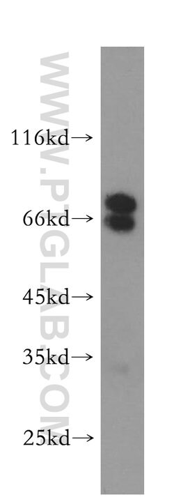 NUMB Rabbit anti-Human, Mouse, Polyclonal, Proteintech 150 &mu;L; Unconjugated:Antibodies,