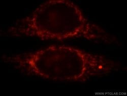CPS1 Rabbit anti-Human, Mouse, Rat, Polyclonal, Proteintech:Antibodies:Primary