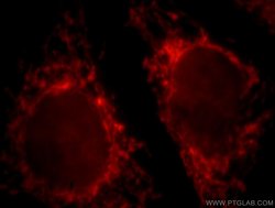 CPS1 Rabbit anti-Human, Mouse, Rat, Polyclonal, Proteintech:Antibodies:Primary
