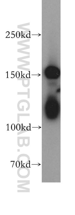 CPS1 Rabbit anti-Human, Mouse, Rat, Polyclonal, Proteintech:Antibodies:Primary