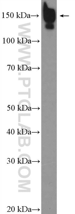 CPS1 Rabbit anti-Human, Mouse, Rat, Polyclonal, Proteintech:Antibodies:Primary