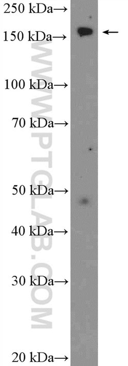 CPS1 Rabbit anti-Human, Mouse, Rat, Polyclonal, Proteintech:Antibodies:Primary