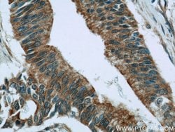 RIC8A Rabbit anti-Human, Polyclonal, Proteintech 150 &mu;L; Unconjugated:Antibodies,