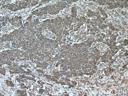 Cytokeratin 18 Rabbit anti-Human, Polyclonal, Proteintech 150 &mu;L; Unconjugated:Antibodies,