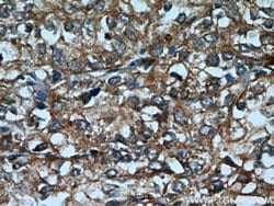Cytokeratin 18 Rabbit anti-Human, Polyclonal, Proteintech 150 &mu;L; Unconjugated:Antibodies,