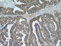 Cytokeratin 18 Rabbit anti-Human, Polyclonal, Proteintech 150 &mu;L; Unconjugated:Antibodies,