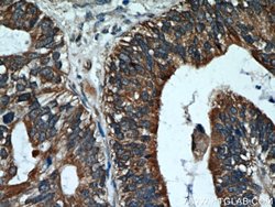 Cytokeratin 18 Rabbit anti-Human, Polyclonal, Proteintech 150 &mu;L; Unconjugated:Antibodies,