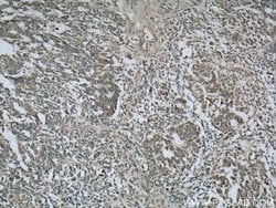 Cytokeratin 18 Rabbit anti-Human, Polyclonal, Proteintech 150 &mu;L; Unconjugated:Antibodies,