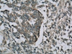 Cytokeratin 18 Rabbit anti-Human, Polyclonal, Proteintech 150 &mu;L; Unconjugated:Antibodies,