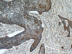 Cytokeratin 18 Rabbit anti-Human, Polyclonal, Proteintech 150 &mu;L; Unconjugated:Antibodies,