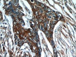 Cytokeratin 18 Rabbit anti-Human, Polyclonal, Proteintech 150 &mu;L; Unconjugated:Antibodies,