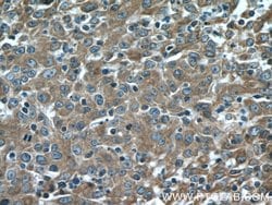 Cytokeratin 18 Rabbit anti-Human, Polyclonal, Proteintech 150 &mu;L; Unconjugated:Antibodies,