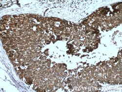 Cytokeratin 18 Rabbit anti-Human, Polyclonal, Proteintech 150 &mu;L; Unconjugated:Antibodies,