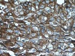 Cytokeratin 18 Rabbit anti-Human, Polyclonal, Proteintech 150 &mu;L; Unconjugated:Antibodies,