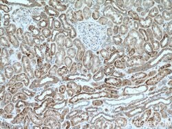 Cytokeratin 18 Rabbit anti-Human, Polyclonal, Proteintech 150 &mu;L; Unconjugated:Antibodies,