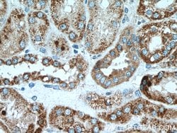 Cytokeratin 18 Rabbit anti-Human, Polyclonal, Proteintech 150 &mu;L; Unconjugated:Antibodies,