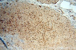 Cytokeratin 18 Rabbit anti-Human, Polyclonal, Proteintech 150 &mu;L; Unconjugated:Antibodies,