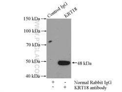 Cytokeratin 18 Rabbit anti-Human, Polyclonal, Proteintech 150 &mu;L; Unconjugated:Antibodies,