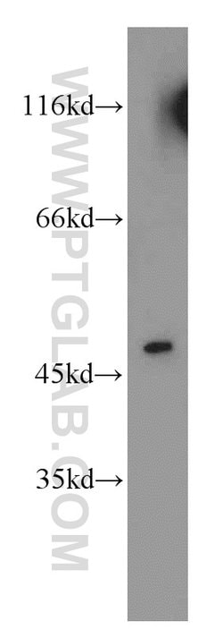 Cytokeratin 18 Rabbit anti-Human, Polyclonal, Proteintech 150 &mu;L; Unconjugated:Antibodies,