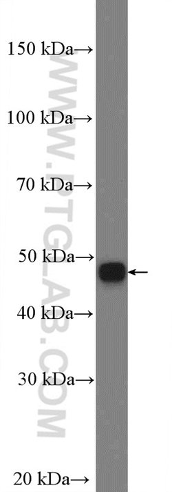 Cytokeratin 18 Rabbit anti-Human, Polyclonal, Proteintech 150 &mu;L; Unconjugated:Antibodies,
