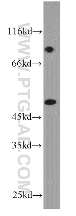 Cytokeratin 18 Rabbit anti-Human, Polyclonal, Proteintech 150 &mu;L; Unconjugated:Antibodies,