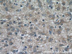 RAB9A Rabbit anti-Human, Polyclonal, Proteintech 150 &mu;L; Unconjugated:Antibodies,