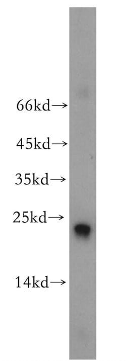 RAB9A Rabbit anti-Human, Polyclonal, Proteintech 150 &mu;L; Unconjugated:Antibodies,