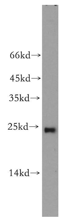 RAB9A Rabbit anti-Human, Polyclonal, Proteintech 150 &mu;L; Unconjugated:Antibodies,