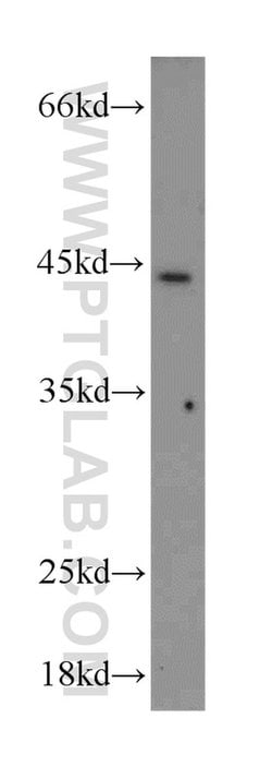 HOXB1 Rabbit anti-Human, Mouse, Polyclonal, Proteintech:Antibodies:Primary
