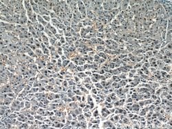 HOXD13 Rabbit anti-Human, Mouse, Rat, Polyclonal, Proteintech 150 &mu;L | Buy Online | Proteintech Group Inc | Fisher Scientific