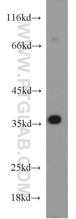 HOXD13 Rabbit anti-Human, Mouse, Rat, Polyclonal, Proteintech 150 &mu;L | Buy Online | Proteintech Group Inc | Fisher Scientific