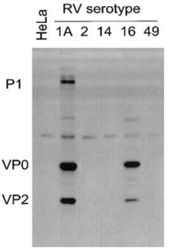 Rhinovirus 16 Monoclonal Antibody (R167), QED Bioscience 100 μg; UnconjugatedAntibodies