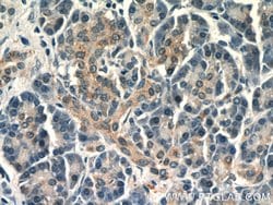 Twinkle Rabbit anti-Human, Polyclonal, Proteintech 150 &mu;L; Unconjugated:Antibodies,