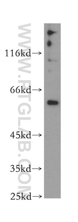 Twinkle Rabbit anti-Human, Polyclonal, Proteintech 150 &mu;L; Unconjugated:Antibodies,