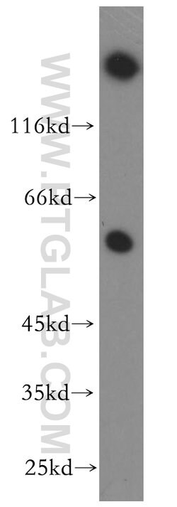 HSF4 Rabbit anti-Human, Mouse, Polyclonal, Proteintech 150 &mu;L; Unconjugated:Antibodies,