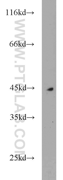 MEPE Rabbit anti-Human, Polyclonal, Proteintech 150 &mu;L | Buy Online | Proteintech Group Inc | Fisher Scientific