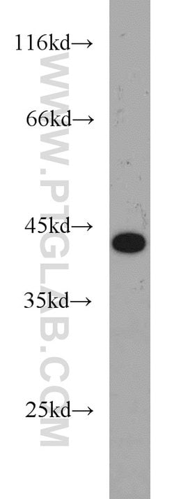 MEPE Rabbit anti-Human, Polyclonal, Proteintech 150 &mu;L | Buy Online | Proteintech Group Inc | Fisher Scientific