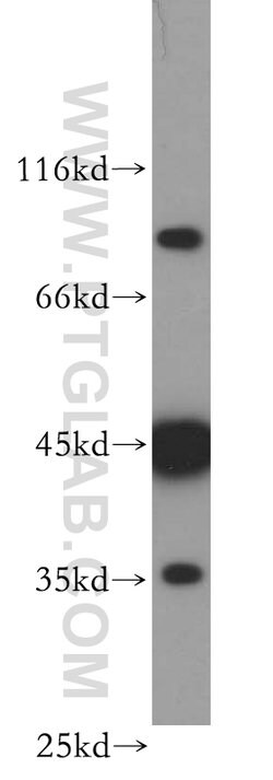 MEPE Rabbit anti-Human, Polyclonal, Proteintech 150 &mu;L | Buy Online | Proteintech Group Inc | Fisher Scientific