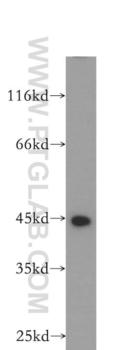 MEPE Rabbit anti-Human, Polyclonal, Proteintech 150 &mu;L | Buy Online | Proteintech Group Inc | Fisher Scientific