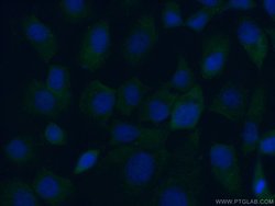 MYO16 Rabbit anti-Human, Mouse, Polyclonal, Proteintech:Antibodies:Primary